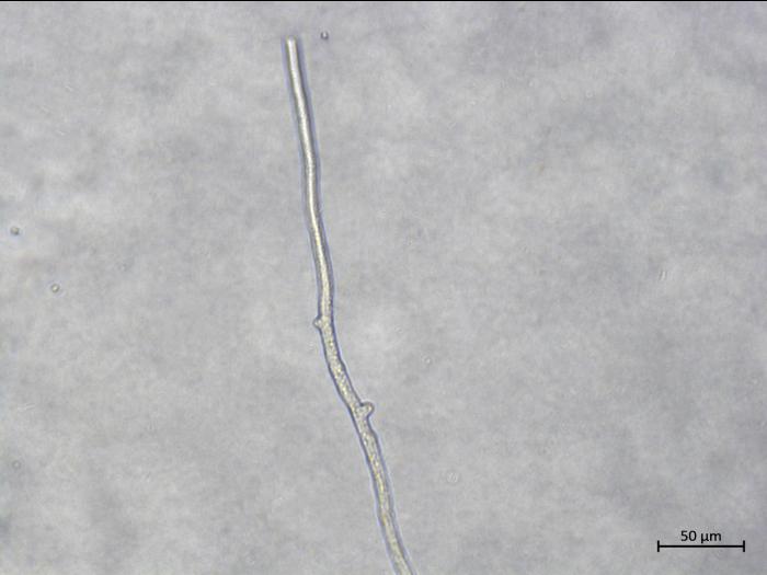 Aphanomyces_euteiches_3
