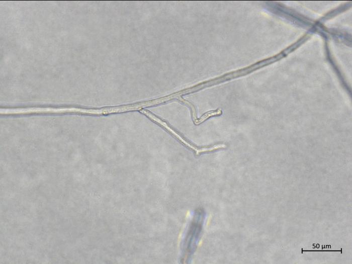 Aphanomyces_euteiches_4