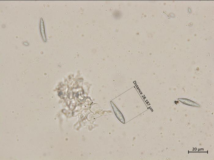 Botryosphaeria_dothidea_4