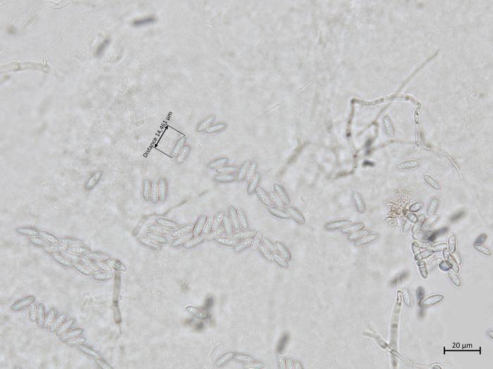 Colletotrichum_acutatum_5