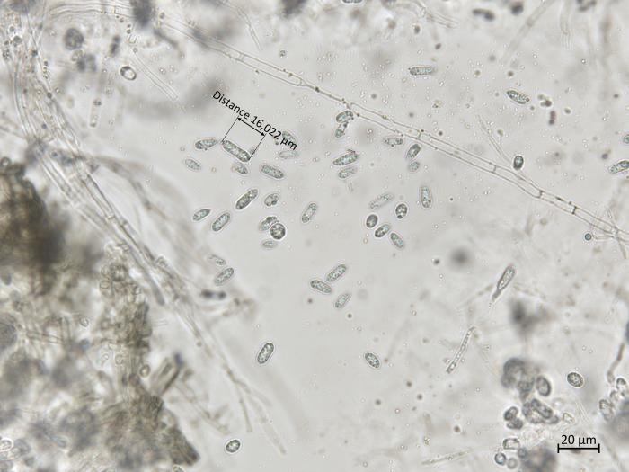 Colletotrichum_coccodes_9