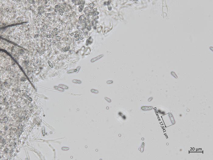 Colletotrichum_coccodes_7