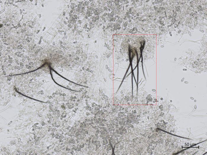 Colletotrichum_coccodes_6