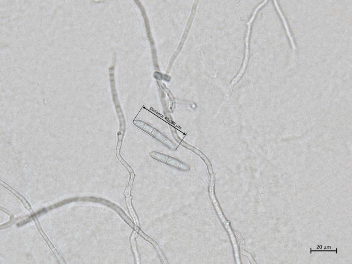 Dactylonectria_torresensis_1