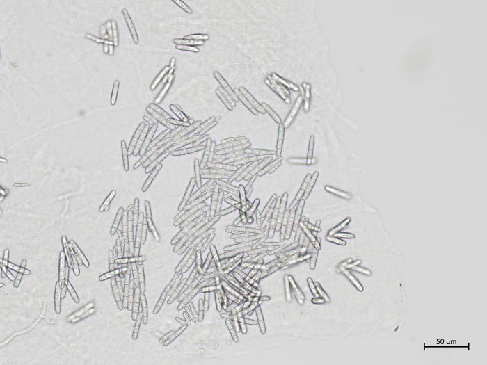 Dactylonectria_torresensis_2