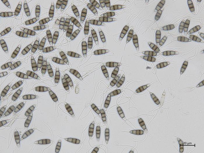 Neopestalotiopsis_sp_2