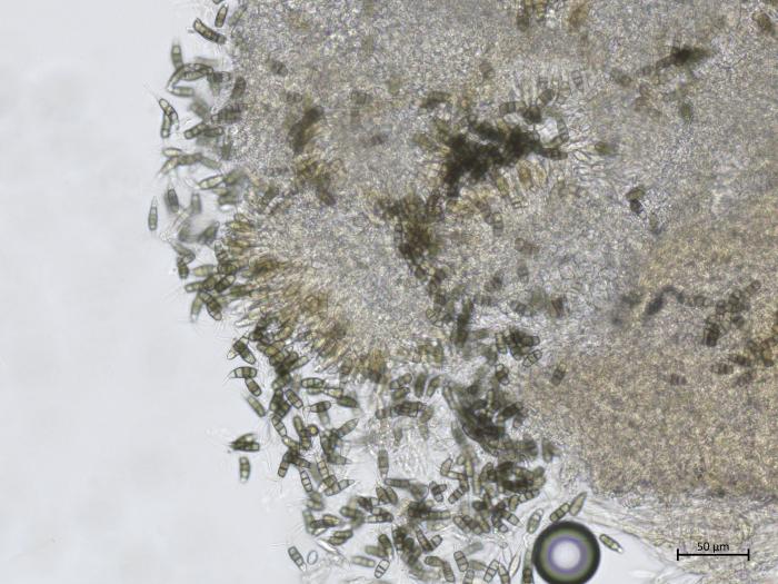 Neopestalotiopsis_sp_1