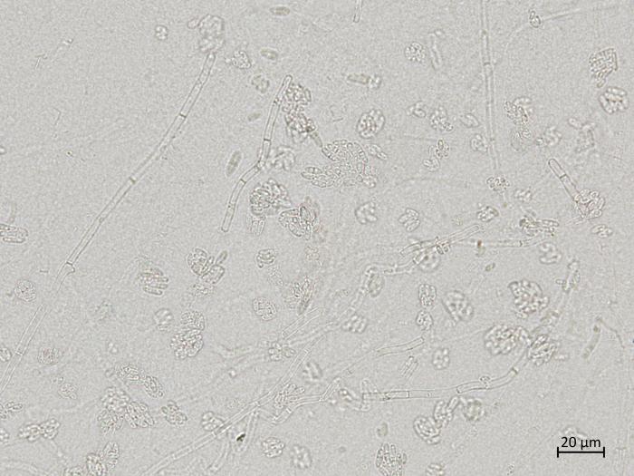 Plectosphaerella_cucumerina_2