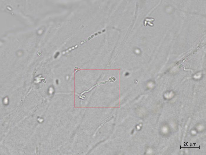 Plectosphaerella_cucumerina_5