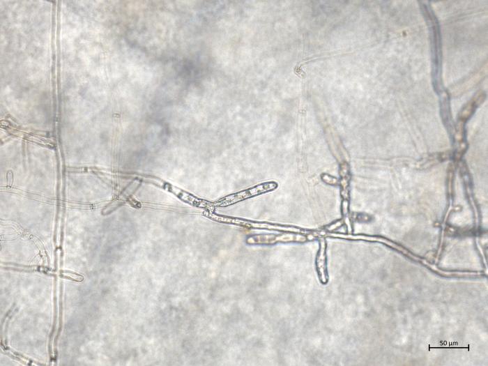 Rhizoctonia_solani_4