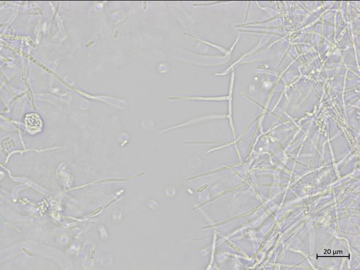 Sarocladium_strictum_2