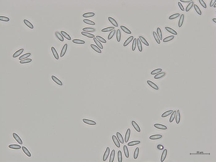 Colletotrichum_fioriniae_2
