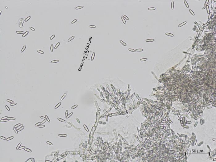 Colletotrichum_fioriniae_4