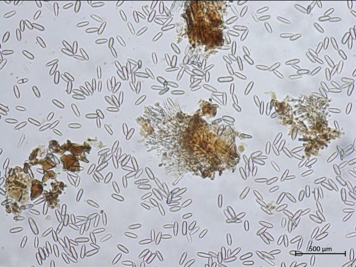 Colletotrichum_fioriniae_5