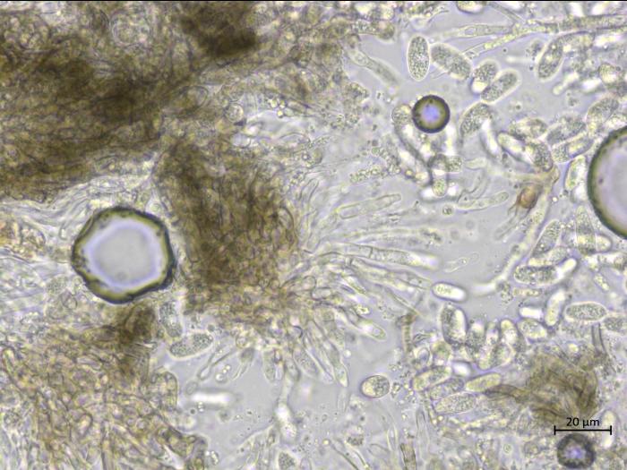 Colletotrichum_petchii_1