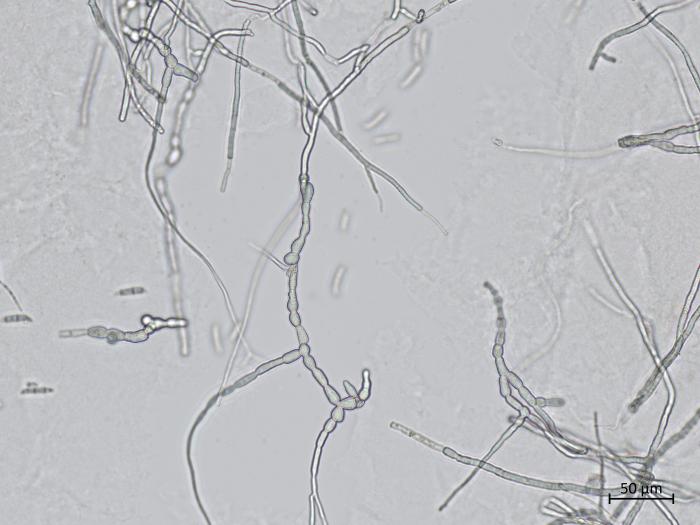 Fusarium_sambucinum_8