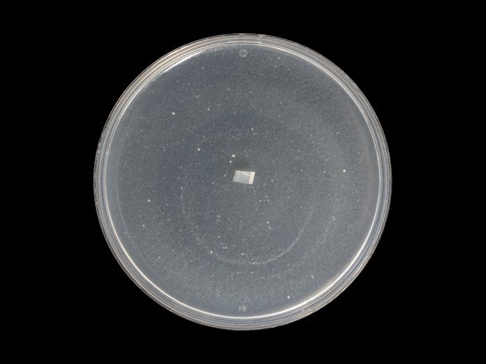 Globisporangium_irregulare_8