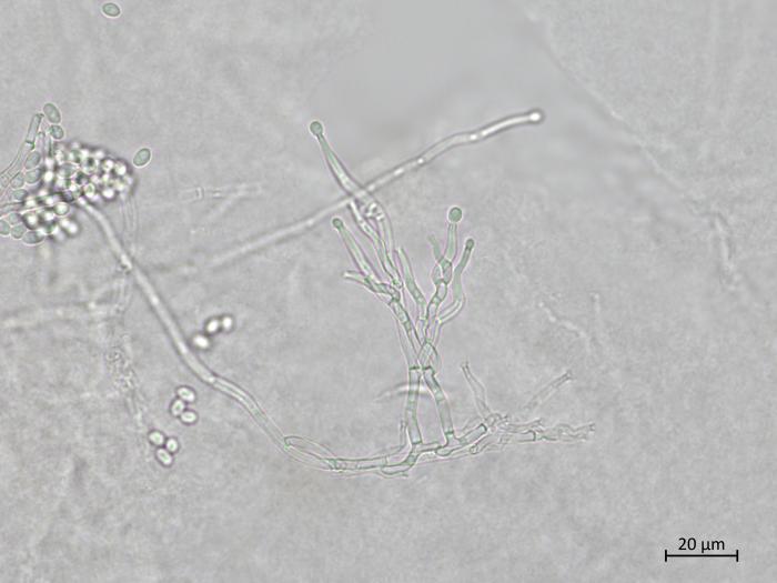 Ilyonectria_liriodendri_1