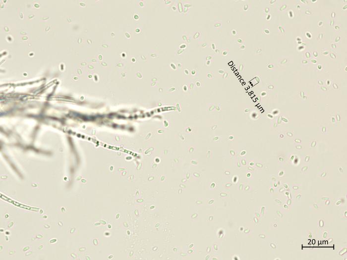 Phaeoacremonium_minimum_9