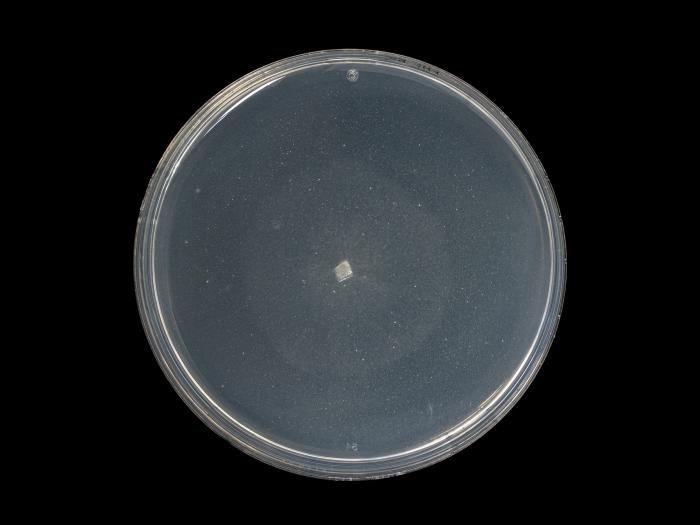 Phytophthora_erythroseptica_3
