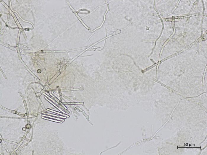 Calonectria_sp_3
