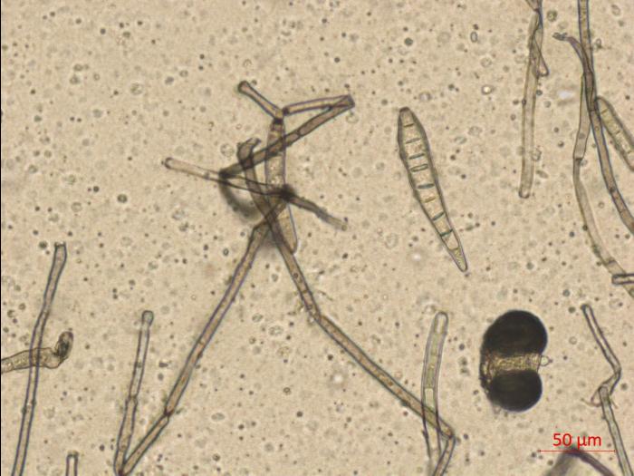 Corynespora_sp_1