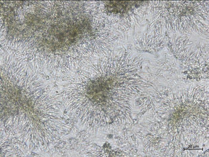 Cytospora_sp_3