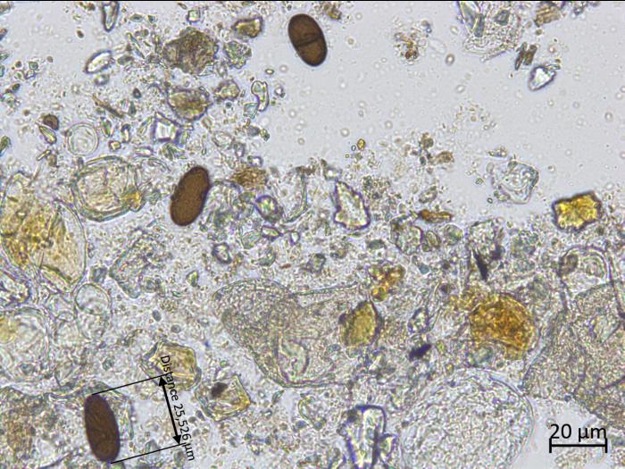 Diplodia_sp_3