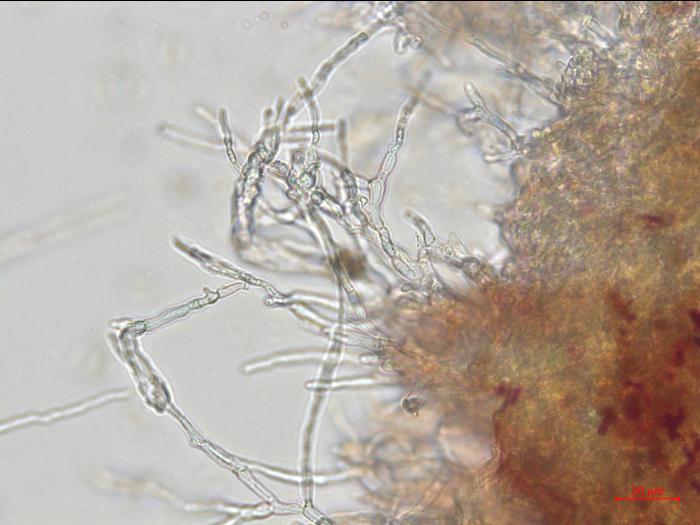 Elsinoe_ampelina_8