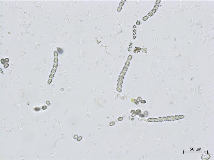 Phyllachora_maydis_2