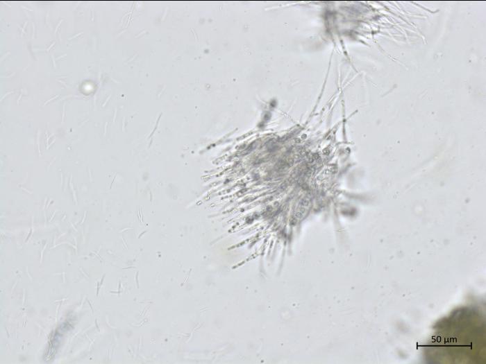 Phyllachora_maydis_3