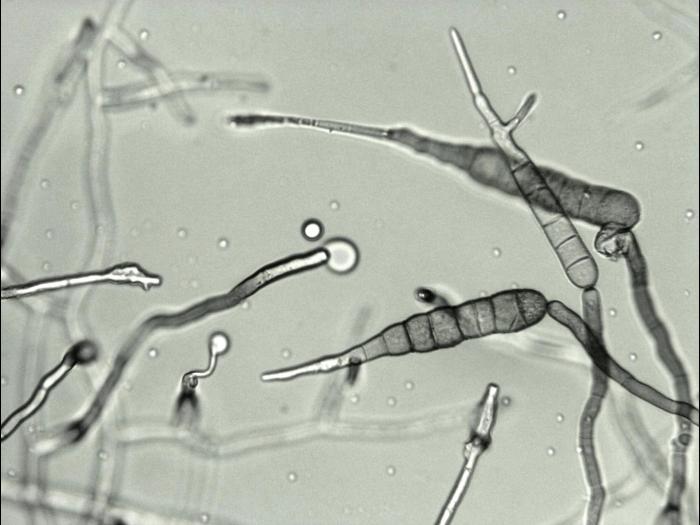 Alternaria_solani_10