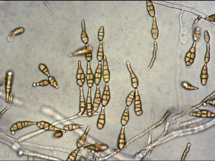 Alternaria_alternata_1