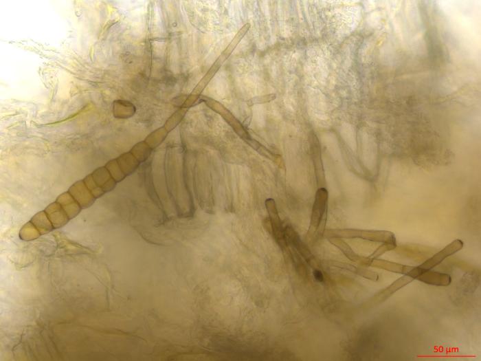 Alternaria_brassicae_2