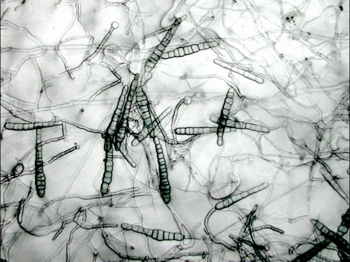 Alternaria_chrysanthemi-01_LQ