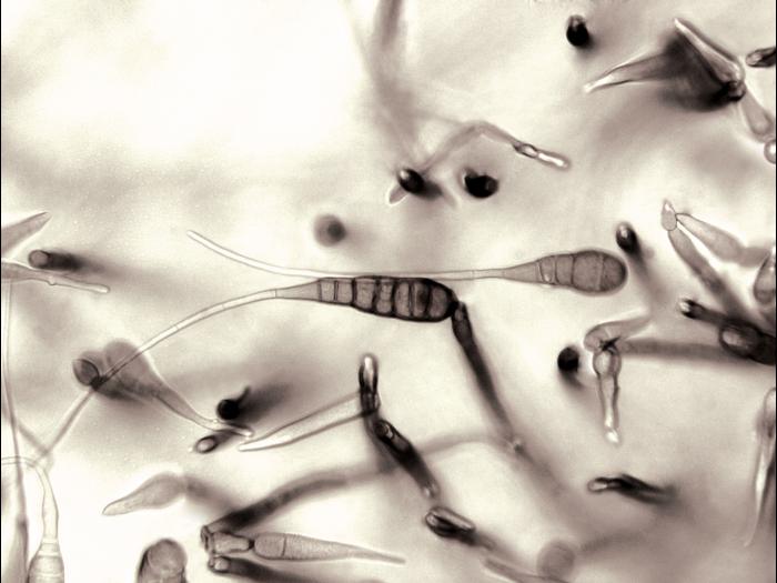 Alternaria_cichorii_3