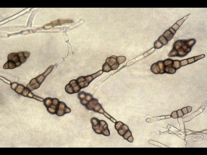 Alternaria_sp_3