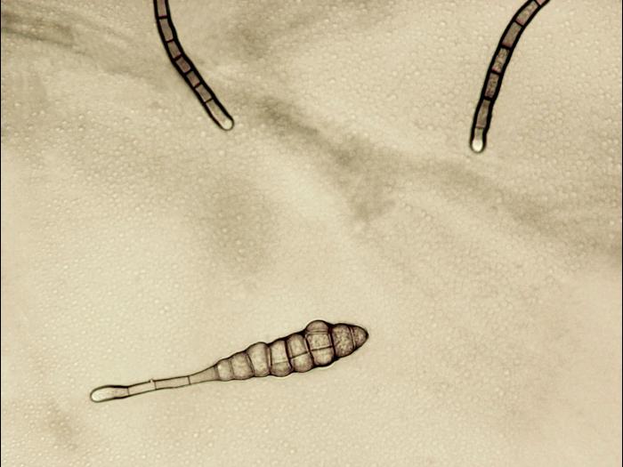 Alternaria_tagetica_3