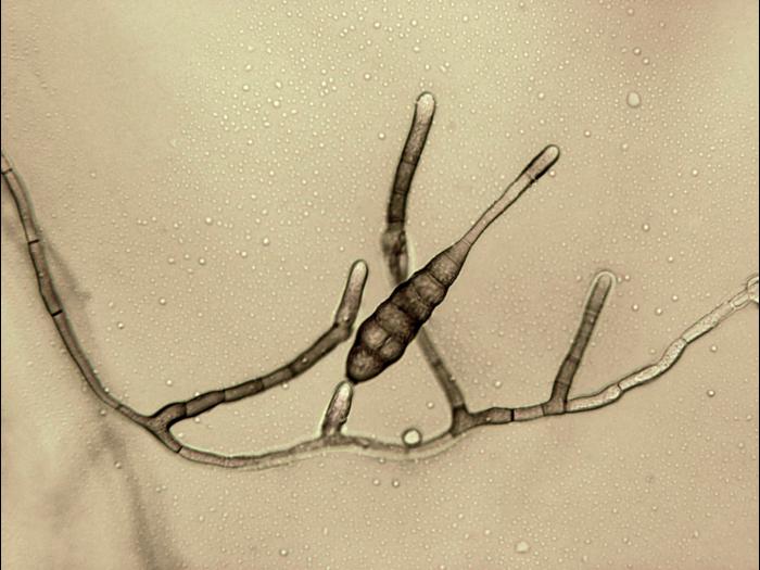 Alternaria_tagetica_1