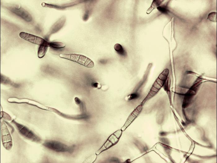 Alternaria_tenuissima-11_LQ