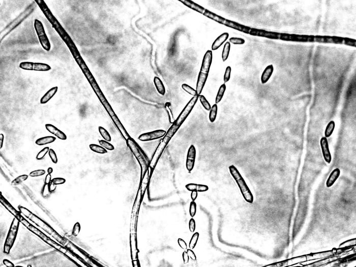 Cladosporium_cucumerinum-01