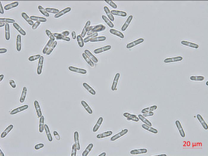 Colletotrichum_coccodes_D35079-3_LQ