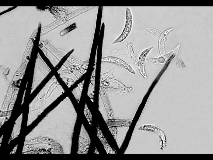 Colletotrichum_graminicola_1