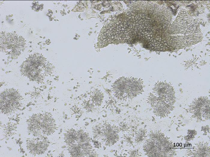 Coniella_diplodiella_2