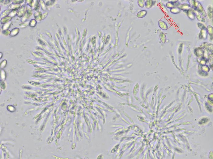 Coniella_diplodiella_4