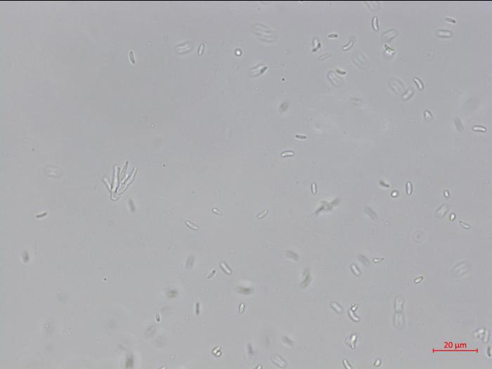 Cytospora_leucostoma_1