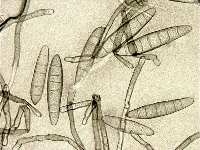 Exserohilum_turcicum_1