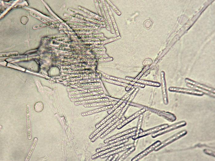 Cylindrocladium_sp_1