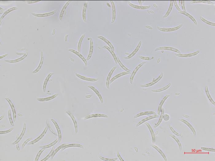 Fusarium_oxysporum_3