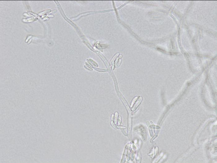 Fusarium_proliferatum_4
